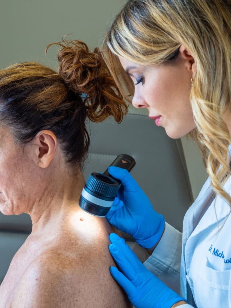 Mappatura dei nei È un esame microscopico di superficie. Durante la dermatoscopia, si utilizza uno strumento digitale attraverso il quale si ottiene un ingrandimento delle lesioni e senza alcuni riflessi della luce.