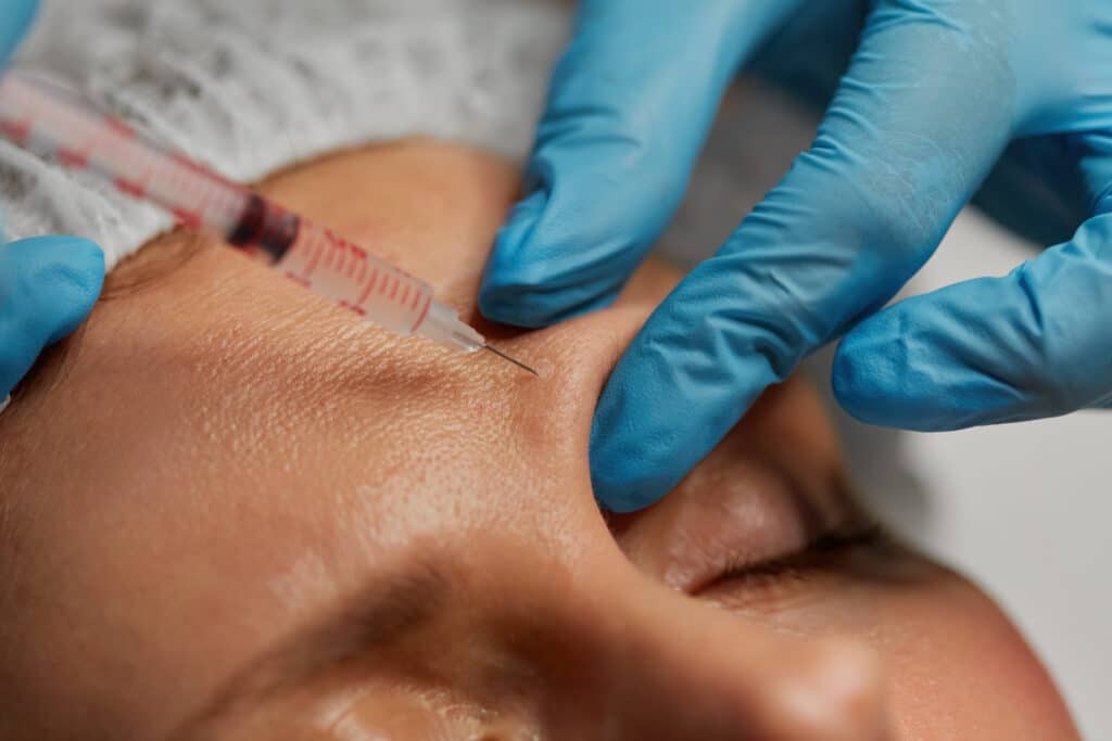Closeup cosmetologist hand with syringe injecting liquid into human skin